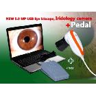 5.0 MP USB Pedal Iriscope Iris Analyzer Iridology camera Iris Diagnosis System 990U & Iris Software